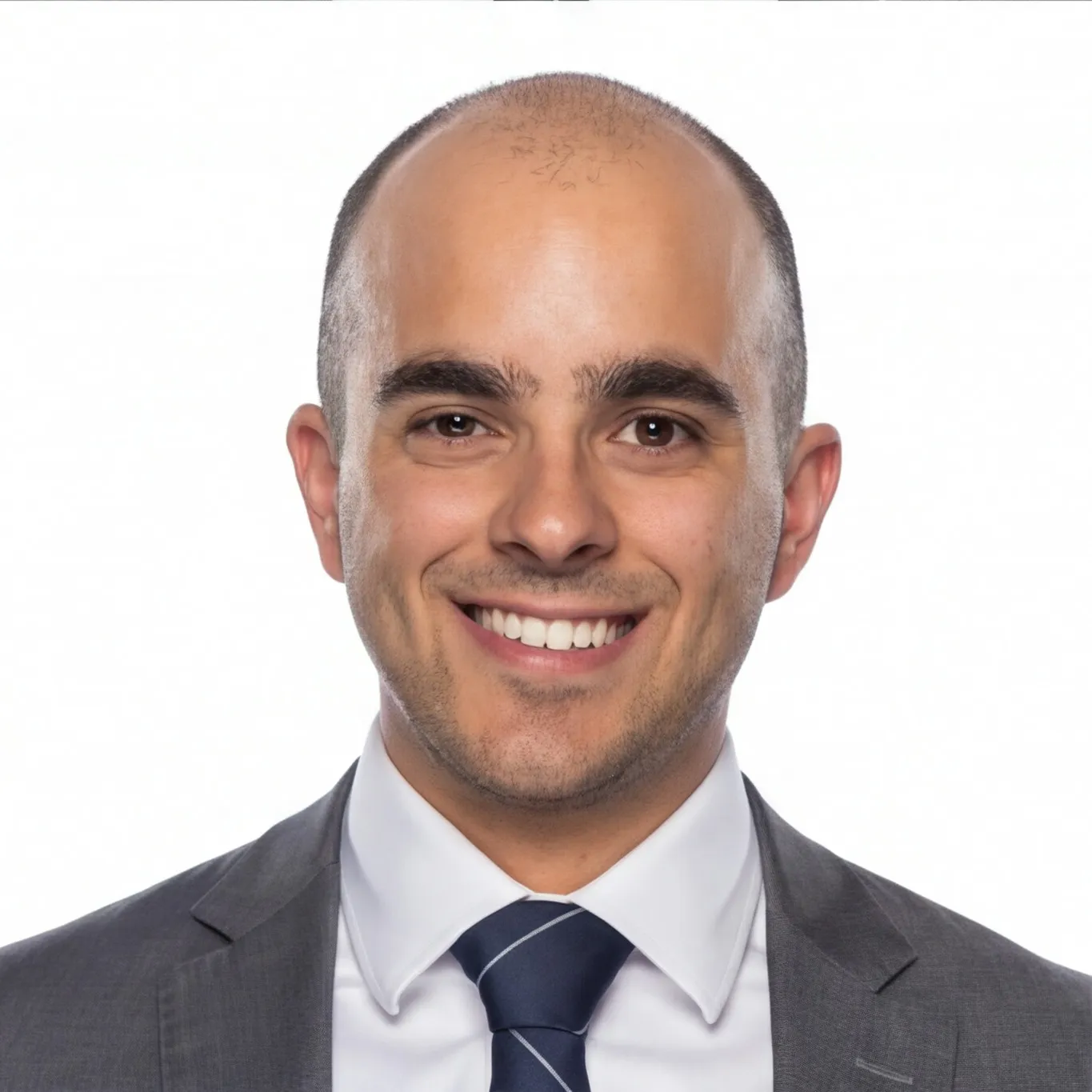 Hair loss simulation