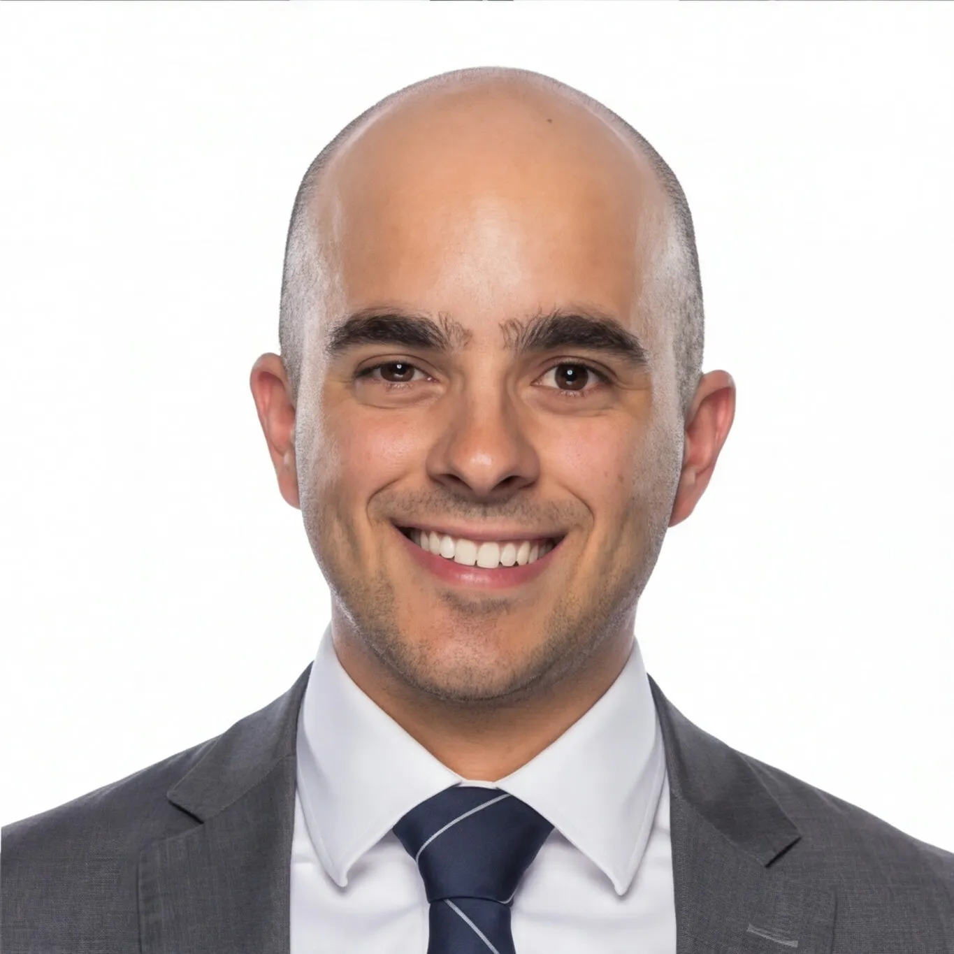 Hair loss simulation