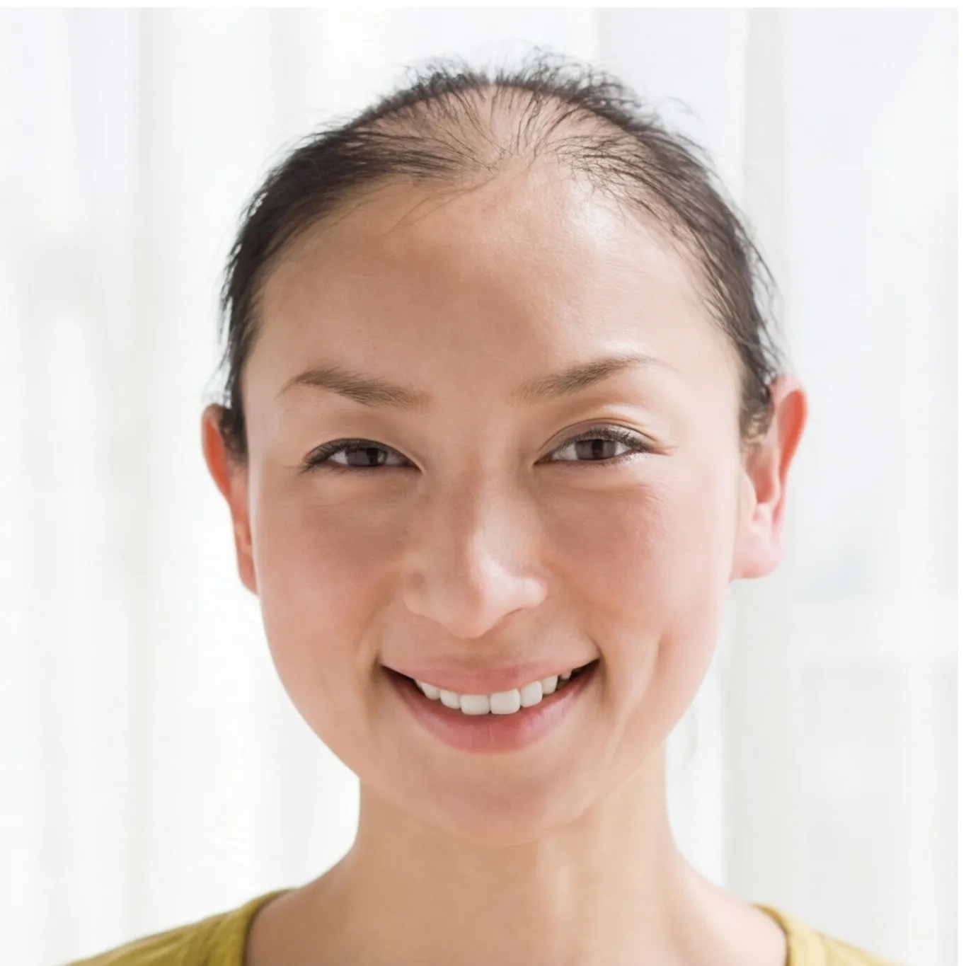 Hair loss simulation